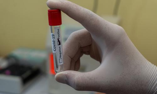 Gloved doctor holds a COVID-19 test marked "positive."